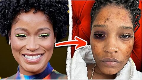 How KeKe Palmer Fell Into A Dangerous Secret Life Of Abuse - Documentary