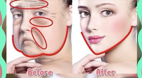 8 Main Face Lift + slim jawline + No eye bags + double chine