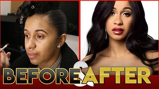 CARDI B | BEFORE & AFTER TRANSFORMATION ( Plastic Surgery )