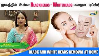 முகத்தில் உள்ள Blackheads - Whiteheads மறைய எளிய வழிமுறைகள் | Black and White Heads Removal at Home