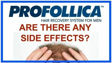 Profollica Review - IT WORKS? Profollica Hair Supplement - PROFOLLICA - Profollica Reviews