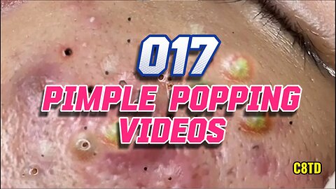 Satisfying Pimple Popping Videos 017
