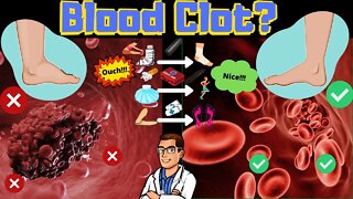 Blood Clot Symptoms & Signs [Causes & Treatment of Leg Blood Clots]