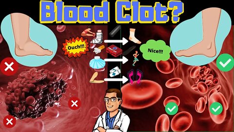 Blood Clot Symptoms & Signs [Causes & Treatment of Leg Blood Clots]