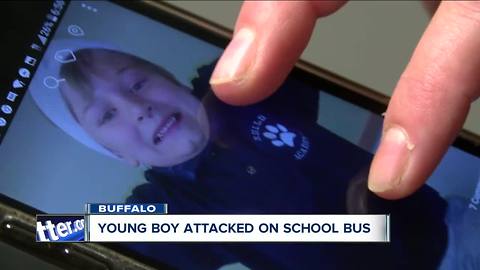 Mom: My 6-year-old son was beaten on his school bus and needed staples in his head