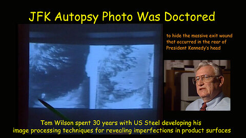 JFK Autopsy Photo Was Doctored