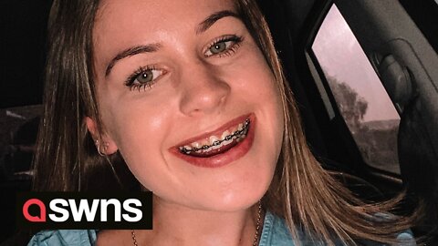New Zealand woman with front teeth 2cm apart shows off her transformed smile