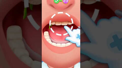 ASMR DENTAL TREATMENT ANIMATION#animation #viralvideo #asmr #shorts