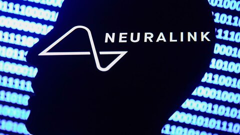 If You Use Neuralink, The Wires Might Retract in Your Brain