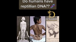 HUMANS WITH REPTILIAN DNA🧬🔬👩‍🔬HAVE FUSED FINGERS🖖CLAW HANDS🤘GROW TAILS🦎👨‍🔬👥💫