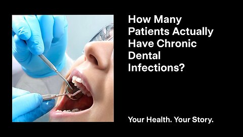 How Many Patients Actually Have Chronic Dental Infections?