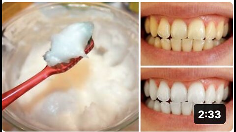 How to Naturally Whiten Your Teeth at Home In 3 Minutes