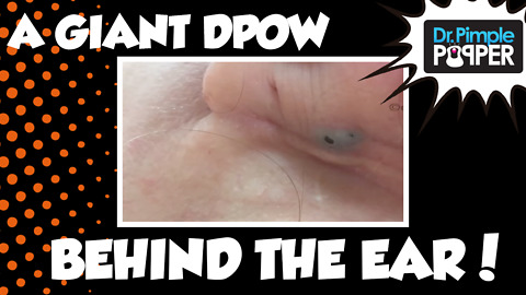 Big DPOW on the EAR