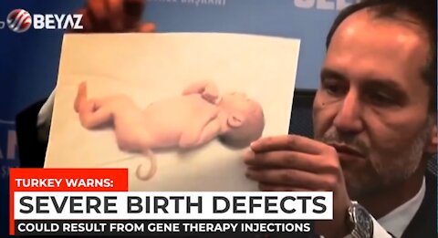 WARNING! | BABIES WITH BIZARRE BIRTH DEFECTS BEING BORN TO "POISONED" PAIR-RENTS | Disturbing!!