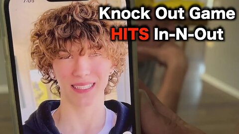 Knock Out Game Costs Teen Teeth