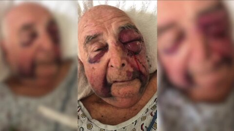 'The good Lord took care of me', 85-year-old Canton man grateful for surviving brutal attack
