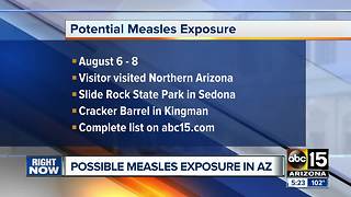 Potential measles exposure reported in northern Arizona