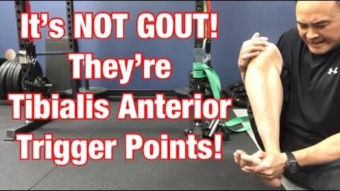 It’s NOT GOUT! They’re Tibialis Anterior Trigger Points! | Dr Wil & Dr K