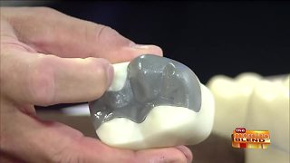 The Latest and Best Options for Dental Crowns