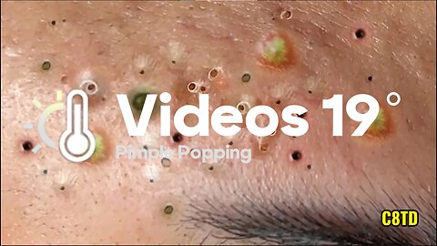 Satisfying Pimple Popping Videos 019