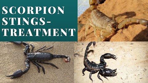 Scorpions Sting – Symptoms And Treatments
