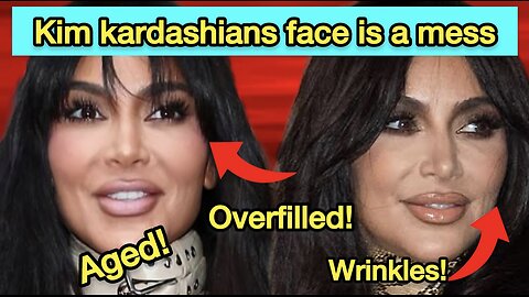 Kim K face is overdone! Too many fillers!
