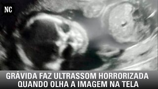 Grávida faz ultrassom e fica alarmada quando olha a imagem na tela