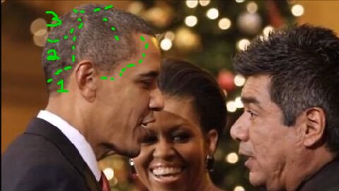Obama SCARS On Head/Neck? FAKE Black President? - Barry Soetoro - 2016