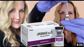 How to Dissolve Filler with Liprorase // Filler Safety