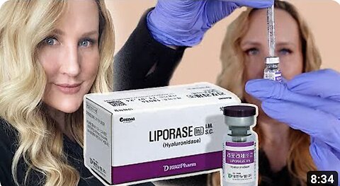How to Dissolve Filler with Liprorase // Filler Safety