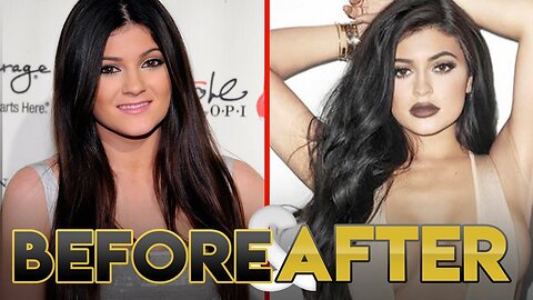 KYLIE JENNER | Before & After | Transformation ( Lips, Plastic Surgery and Workout )