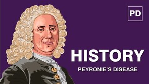 History of Peyronie’s Disease | Treatment Options Of Peyronies Disease | Mansmatters
