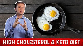 High Cholesterol on a Ketogenic diet? – Dr. Berg on Keto and Cholesterol