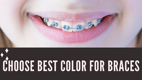 how to choose color of braces｜｜choosing braces color