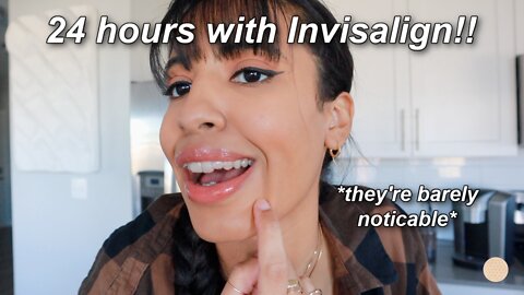 My First 24 Hours With Invisalign