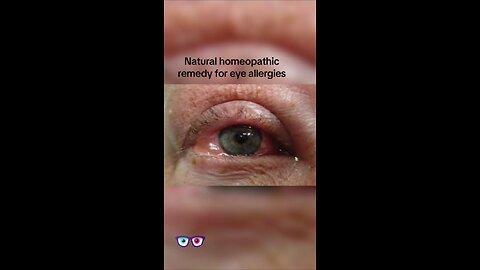 Natural remedy for red eyes and eye allergies