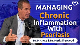 Managing the Chronic Inflammation of Psoriasis | FurtherMore with the Sherwoods Ep. 65