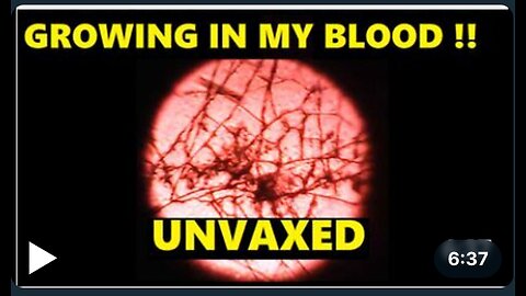 MY UNVAXED BLOOD FROM 4 MONTHS AGO HAS FORMED FIBRES !!