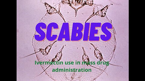 Scabies: Ivermectin use in mass drug administration