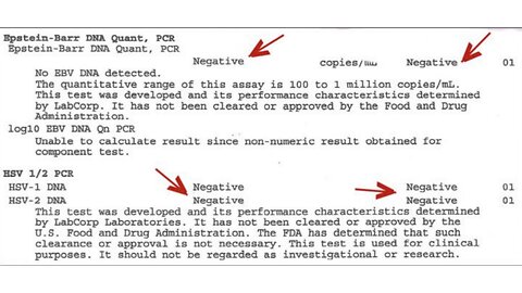 Epstein-Barr PCR Test - NEGATIVE Following Scalar Light Sessions
