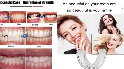 Invisible Braces Orthodontic Braces | Hollywood smile