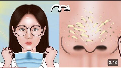 Satisfying Full Blackhead Treatment At Home! ASMR skincare animation丨Meng's Stop Motion