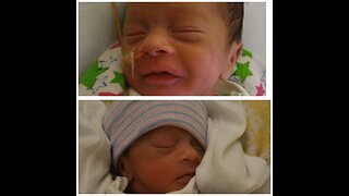 Preemie Baby Twins Born at 29 Weeks - Their NICU Birth Story
