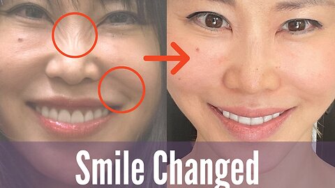 Smile Changed!