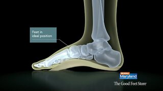 The Good Feet Store - Health Benefits
