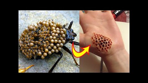 10 Most Dangerous Bugs in the World