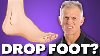 What is foot drop and How do you treat it?