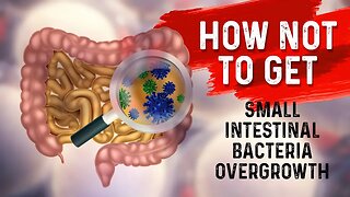 How to STOP Small Intestine Bacterial Overgrowth(SIBO)? – Dr. Berg