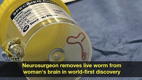 Neurosurgeon removes live worm from woman's brain in world-first discovery | DW News Aug 29, 2023