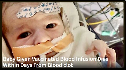 Baby Given Vaccinated Blood Infusion Dies Within Days From Blood clot